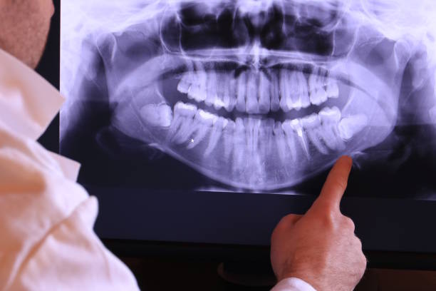 Best Emergency Care for Gum Disease in Latimer, MS